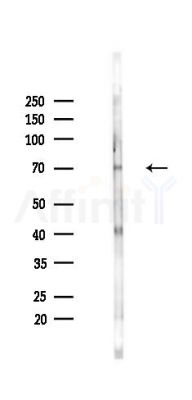 ZFP64 Antibody - Western blot analysis of lysates from Mouse lung, using ZFP64 Antibody at 1/1000 dilution.
