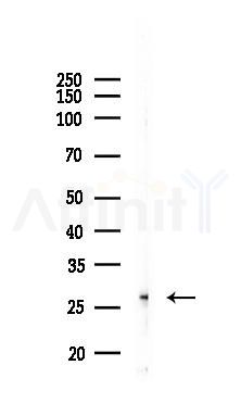 EFHD1 Antibody - Western blot analysis of lysates from RAW264.