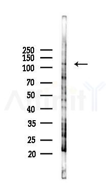 KIAA0319 Antibody - Western blot analysis of lysates from PC12 cells(LPS 4h treatment), using KIAA0319 Antibody at 1/1000 dilution.