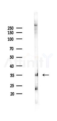 FAM181A Antibody - Western blot analysis of lysates from K562 cells(starvation 24h treatment), using FAM181A Antibody at 1/1000 dilution.