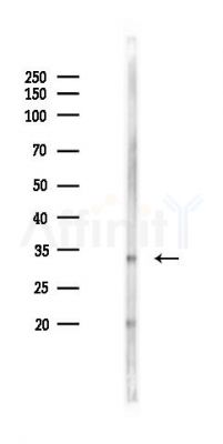 FAM181A Antibody - Western blot analysis of lysates from B16F10-LUC cells(starvation 24h treatment), using FAM181A Antibody at 1/1000 dilution.