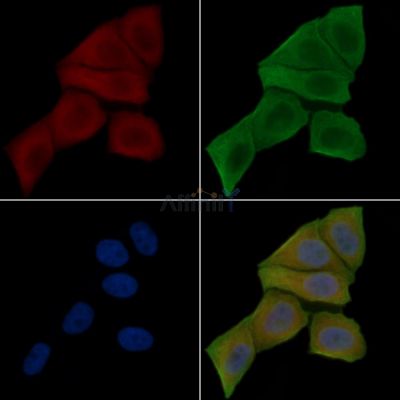 STON2 Antibody - DF15083 staining Hela cells(30min of UV treatment) by IF/ICC.