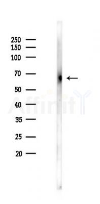 AP1G2 Antibody - Western blot analysis of lysates from B16F10-LUC cells(starvation 24h treatment), using AP1G2 Antibody at 1/1000 dilution.
