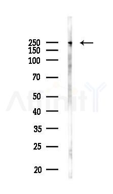 CCDC88C Antibody - Western blot analysis of lysates from Hela cells(LPS 4h treatment), using CCDC88C Antibody at 1/1000 dilution.