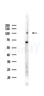 SLFN5 Antibody - Western blot analysis of lysates from B16F10-LUC cells(heat-shock 45min treatment), using SLFN5 Antibody at 1/1000 dilution.