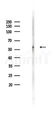 SLC38A6 Antibody - Western blot analysis of lysates from B16F10-LUC cells(starvation 24h treatment), using SLC38A6 Antibody at 1/1000 dilution.