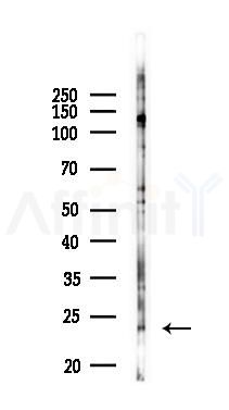THEM6 Antibody - Western blot analysis of lysates from Hela cells(LPS 4h treatment), using THEM6 Antibody at 1/1000 dilution.