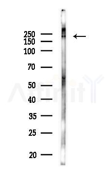 TANC2 Antibody - Western blot analysis of lysates from Hela cells(LPS 4h treatment), using TANC2 Antibody at 1/1000 dilution.