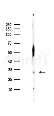 KIAA1107 Antibody - Western blot analysis of lysates from Rat liver, using KIAA1107 Antibody at 1/1000 dilution.
