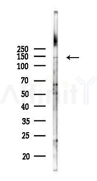 WDR33 Antibody - Western blot analysis of lysates from COLO205 cells(UV 30min treatment), using WDR33 Antibody at 1/1000 dilution.