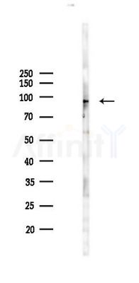 CXorf23 Antibody - Western blot analysis of lysates from B16F10-LUC cells(heat-shock 45min treatment), using CXorf23 Antibody at 1/1000 dilution.