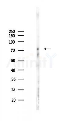 SLC6A7 Antibody - Western blot analysis of lysates from B16F10-LUC cells(heat-shock 45min treatment), using SLC6A7 Antibody at 1/1000 dilution.