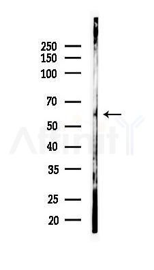 SAMD3 Antibody - Western blot analysis of lysates from A2780 cells(LPS 4h treatment), using SAMD3 Antibody at 1/1000 dilution.