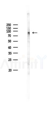 PERM1 Antibody - Western blot analysis of lysates from K562 cells(heat-shock 45min treatment), using PERM1 Antibody at 1/1000 dilution.