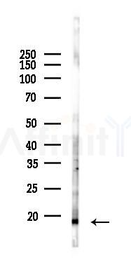 SDHAF4 Antibody - Western blot analysis of lysates from 293 cells(UV 30min treatment), using SDHAF4 Antibody at 1/1000 dilution.
