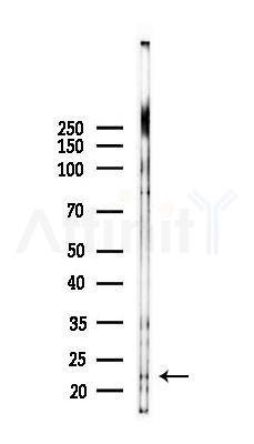 ZNF740 Antibody - Western blot analysis of lysates from Mouse testis, using ZNF740 Antibody at 1/1000 dilution.