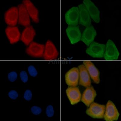 SHCBP1L Antibody - DF15172 staining Hela cells(45min of heat-shock treatment) by IF/ICC.