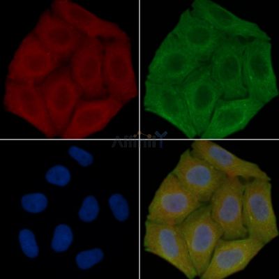 RNF145 Antibody - DF15174 staining Hela cells(30min of UV treatment) by IF/ICC.