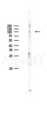 PRMT9 Antibody - Western blot analysis of lysates from PC12 cells(LPS 4h treatment), using PRMT9 Antibody at 1/1000 dilution.