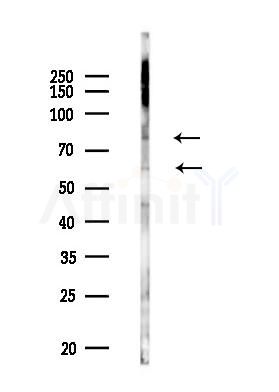 MCMBP Antibody - Western blot analysis of lysates from PC12 cells(LPS 4h treatment), using MCMBP Antibody at 1/1000 dilution.