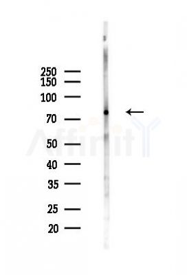 TTC12 Antibody - Western blot analysis of lysates from Rat brain, using TTC12 Antibody at 1/1000 dilution.