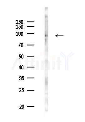 PATL1 Antibody - Western blot analysis of lysates from PC12 cells(LPS 4h treatment), using PATL1 Antibody at 1/1000 dilution.