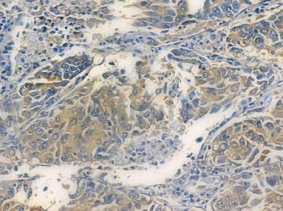 FAM107B Antibody - DF15200 at 1/100 staining human normal kidney tissue by IHC-P.