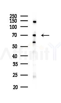 PLCZ1 Antibody - Western blot analysis of lysates from 293 cells(UV 30min treatment), using PLCZ1 Antibody at 1/1000 dilution.