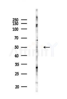 ENPP6 Antibody - Western blot analysis of lysates from PC12 cells(LPS 4h treatment), using ENPP6 Antibody at 1/1000 dilution.