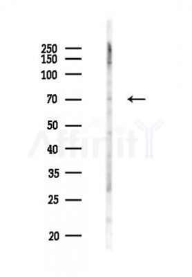 MTHFR Antibody - Western blot analysis of lysates from PC12 cells(LPS 4h treatment), using MTHFR Antibody at 1/1000 dilution.