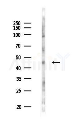 FBXO5 Antibody - Western blot analysis of lysates from PC12 cells(LPS 4h treatment), using FBXO5 Antibody at 1/1000 dilution.