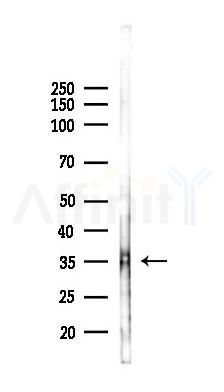 OR4K17 Antibody - Western blot analysis of lysates from B16F10-LUC cells(LPS 4h treatment), using OR4K17 Antibody at 1/1000 dilution.