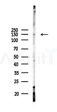 MMRN1 Antibody - Western blot analysis of lysates from COLO205 cells(UV 30min treatment), using MMRN1 Antibody at 1/1000 dilution.