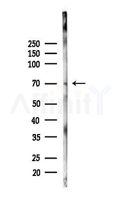 CRELD1 Antibody - Western blot analysis of lysates from Rat liver, using CRELD1 Antibody at 1/1000 dilution.