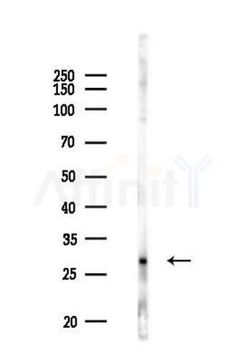 TSPAN13 Antibody - Western blot analysis of lysates from PC12 cells(LPS 4h treatment), using TSPAN13 Antibody at 1/1000 dilution.