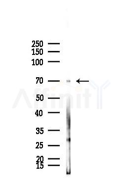 ALAS2 Antibody - Western blot analysis of lysates from Mouse testis, using ALAS2 Antibody at 1/1000 dilution.