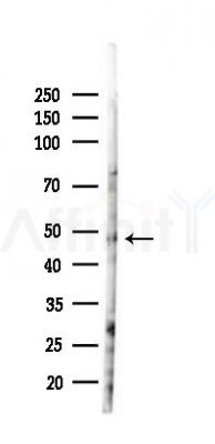 SMYD5 Antibody - Western blot analysis of lysates from PC12 cells(LPS 4h treatment), using SMYD5 Antibody at 1/1000 dilution.
