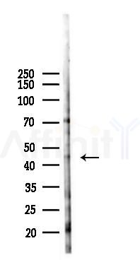 SMYD5 Antibody - Western blot analysis of lysates from K562 cells(heat-shock 45min treatment), using SMYD5 Antibody at 1/1000 dilution.