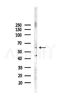 ZNF157 Antibody - Western blot analysis of lysates from K562 cells(heat-shock 45min treatment), using ZNF157 Antibody at 1/1000 dilution.