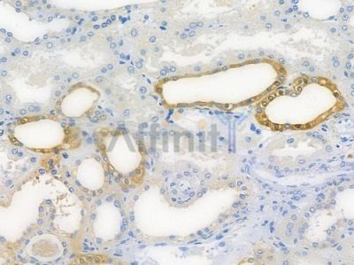 SCYL1 Antibody - DF15273 at 1/100 staining human normal kidney tissue by IHC-P.
