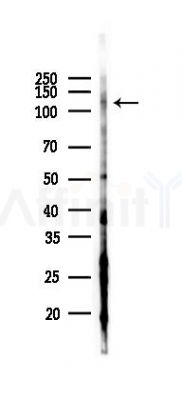 MYT1L Antibody - Western blot analysis of lysates from HUVEC cells(starvation 24h treatment), using MYT1L Antibody at 1/1000 dilution.