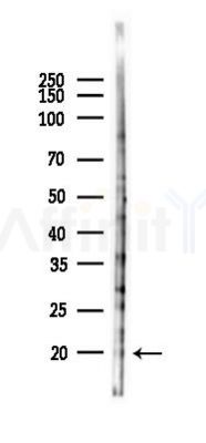 RFLNB Antibody - Western blot analysis of lysates from HUVEC cells(starvation 24h treatment), using RFLNB Antibody at 1/1000 dilution.