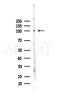 ZNF746 Antibody - Western blot analysis of lysates from Rat liver, using ZNF746 Antibody at 1/1000 dilution.