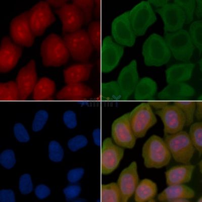 ZNF746 Antibody - DF15298 staining Hela cells(45min of heat-shock treatment) by IF/ICC.
