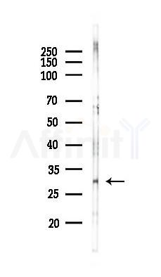 MRO Antibody - Western blot analysis of lysates from COLO205 cells(starvation 24h treatment), using MRO Antibody at 1/1000 dilution.