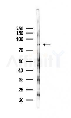 RBM28 Antibody - Western blot analysis of lysates from B16F10-LUC cells(LPS 4h treatment), using RBM28 Antibody at 1/1000 dilution.
