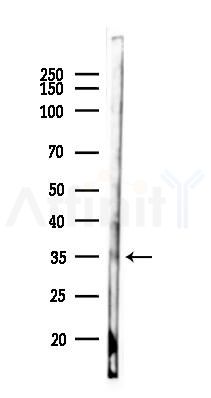 MRNIP Antibody - Western blot analysis of lysates from Mouse lung, using MRNIP Antibody at 1/1000 dilution.