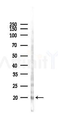 C20orf27 Antibody - Western blot analysis of lysates from RAW264.