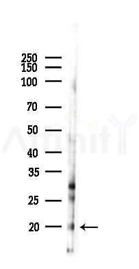 C20orf27 Antibody - Western blot analysis of lysates from HUVEC cells(starvation 24h treatment), using C20orf27 Antibody at 1/1000 dilution.