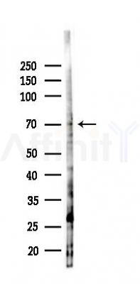 PRAM1 Antibody - Western blot analysis of lysates from PC12 cells(LPS 4h treatment), using PRAM1 Antibody at 1/1000 dilution.